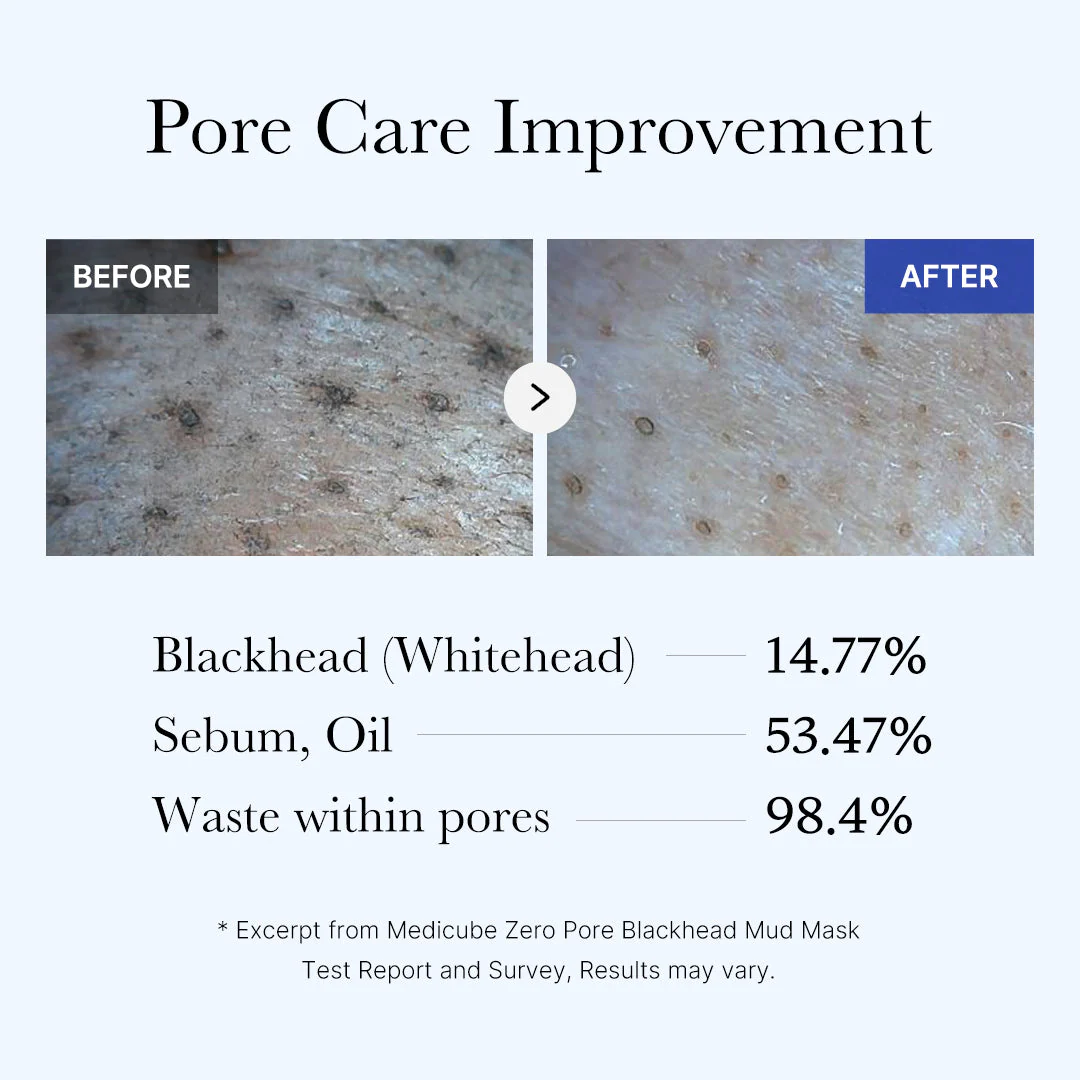 [GIFT] Zero Pore Blackhead Mud Mask - Image 5