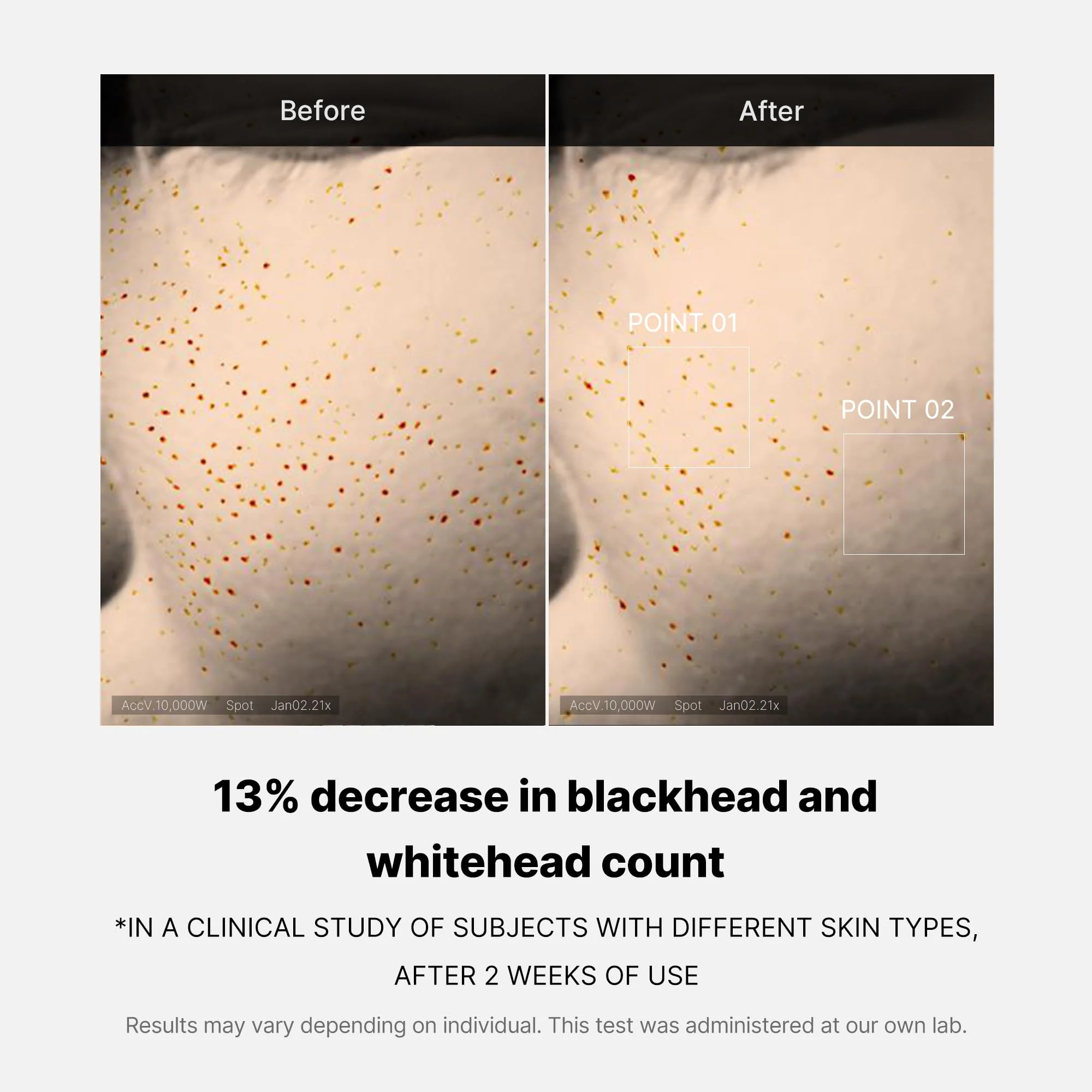 Zero Pore One-day Peptide Serum - Image 7