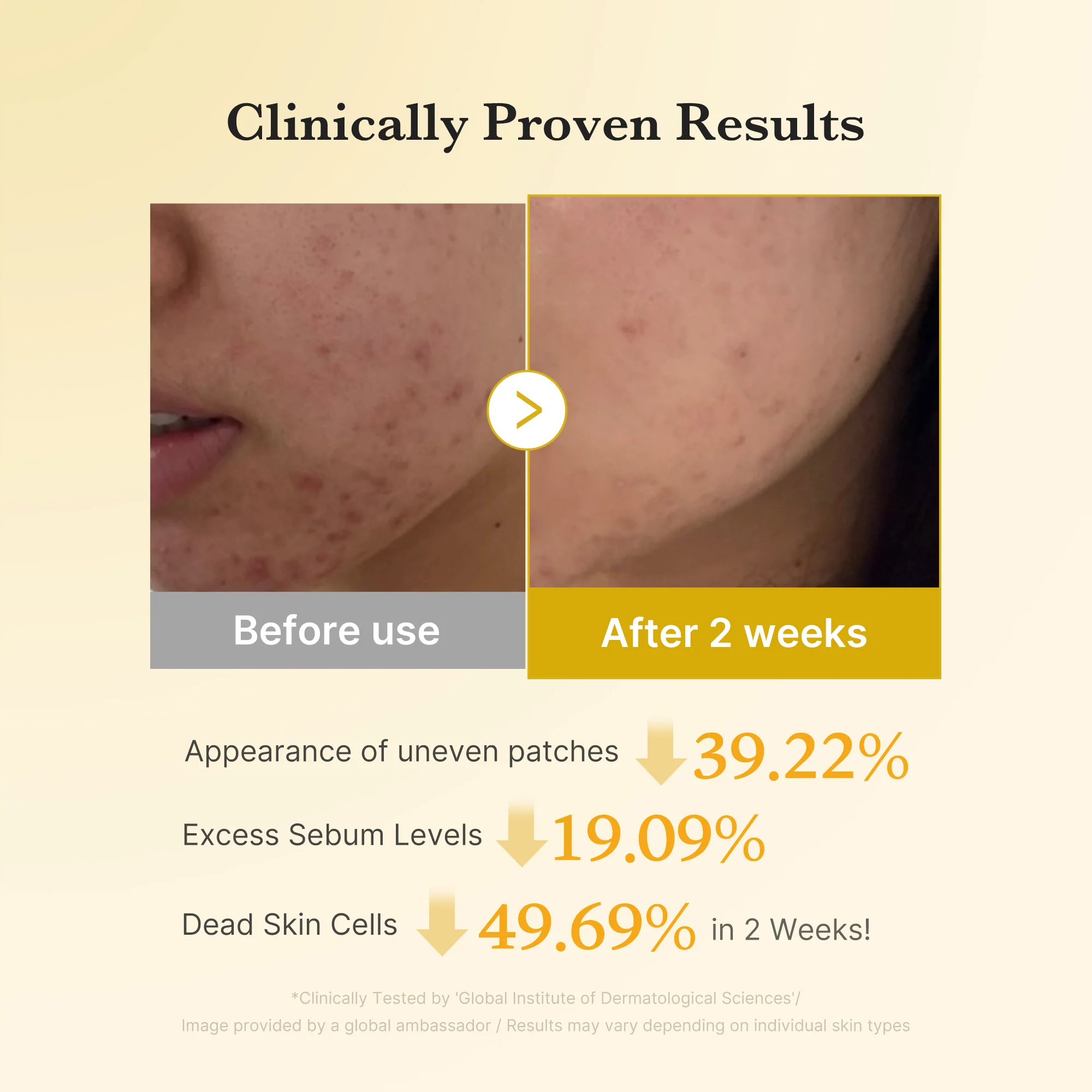 Kojic Acid Tumeric Toner Pad - Image 4